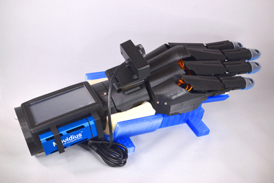 electric upper limb prosthesis